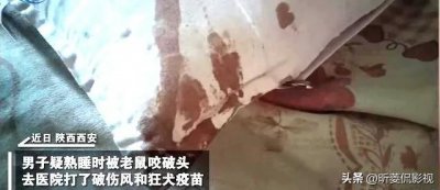 ​男子熟睡时疑被老鼠咬破头 被老鼠咬了有什么危害