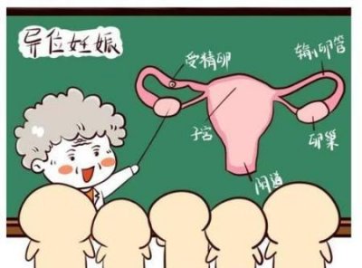 ​最早宫外孕几天可以发现(宫外孕一般多少天能测出来)