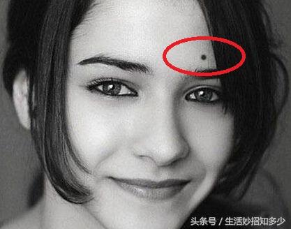 女人哪有痣是最不好的痣（原来女人这五个地方长痣）(2)