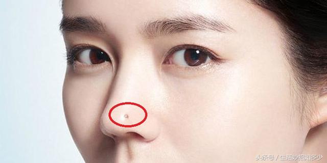 女人哪有痣是最不好的痣（原来女人这五个地方长痣）(4)
