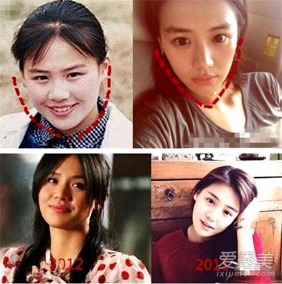 马思纯有没有整容（马思纯疑似开眼角双眼皮痕迹太明显）(1)