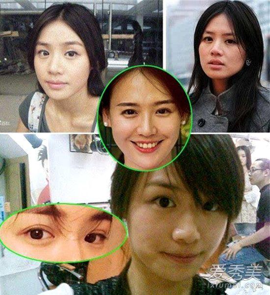 马思纯有没有整容（马思纯疑似开眼角双眼皮痕迹太明显）(3)