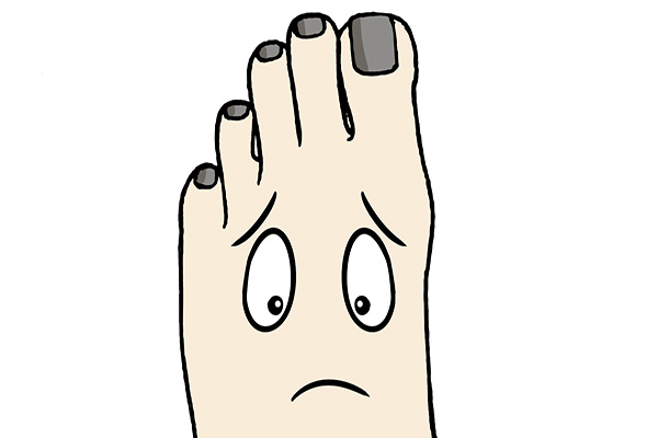 小脚趾甲两瓣的原因（小脚趾指甲分成两瓣对健康的影响）